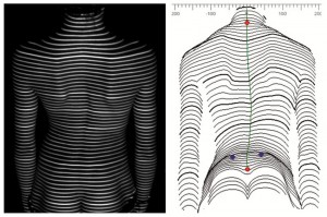 Functional analysis of spine and posture with DIERS Formetric 4D