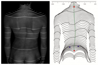 Formetric 4D